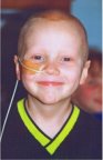 Full of smiles on chemotherapy